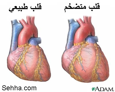 صورة مرفقة