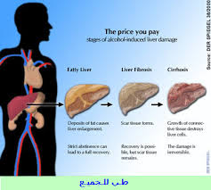 صورة مرفقة